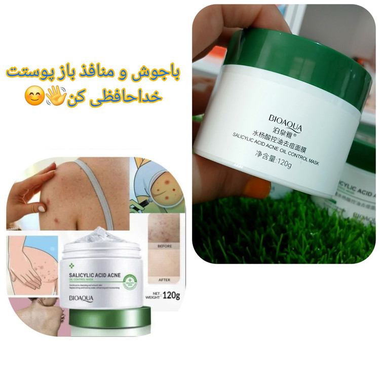 ژل سالیسیلیک اسید ضدجوش بیوآکوا | ۱۲۰ گرم